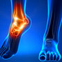 Neuropathy Demystified: Causes, Symptoms & Natural Solutions
